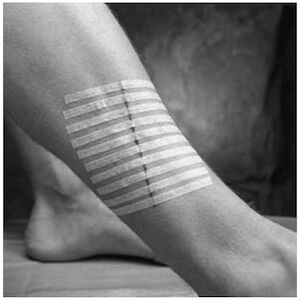 STERI-STRIP CLOS .25X1.5 6PK 50PK/BX 4BX